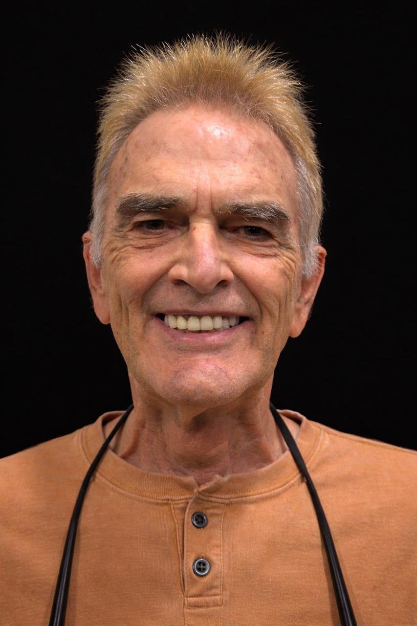 Dr. Borboa smile transformation 17